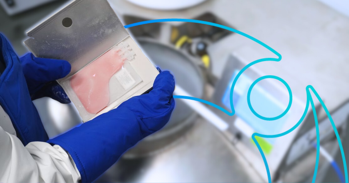 La lente dérive vers la variabilité et les arguments en faveur de la normalisation